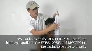 Open Phase Bandaging Technique Burned Face Injury