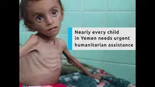 Children in Yemen Need Urgent Help