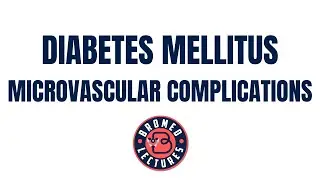 Diabetes Mellitus part 6 Microvascular Complications