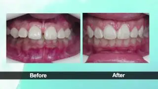 Rita Dargham, DMD - Miami Dentist - Invisalign