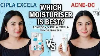 Best Moisturizer for Acne Skin 2025 | Acne OC vs Excela Detailed Review