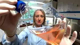 PROF MICHELLE WEST - EPSTEIN BARR VIRUS [EBV] - BLOODWISE SCOTLAND
