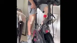 Recovery Day 1 after Partial Knee Revision Surgery. How one patient performed. Everyone is different