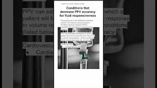 Conditions that decrease PPV accuracy for fluid responsiveness