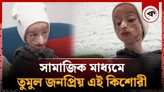 সামাজিক মাধ্যমে তুমুল জনপ্রিয় এই কিশোরী, পরিচয় কী তার? | Anna Korchagina  | Russia | Kalbela