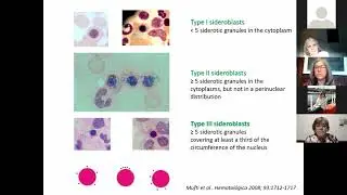 MEET THE EXPERT SESSIONS (Spanish)- Morphology & Cytochemistry