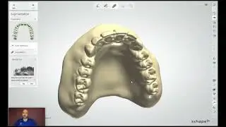 Stratasys Academy | TrueDent용 3Shape 복제 틀니 디자인