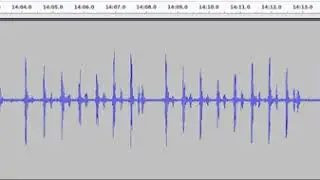 Resting heartrate - 110 bpm