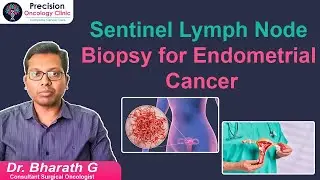 Sentinel Lymph Node Biopsy | Endometrial Cancer | Dr. Bharath G | Surgical Oncologist in India