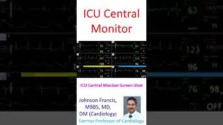 ICU Central Monitor