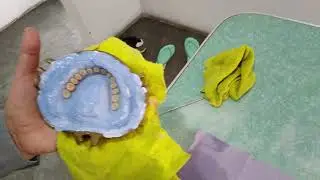 Eliminacion de Cera parte 1