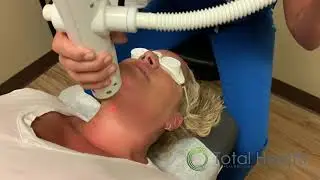 Neck Lines/Wrinkles Laser Treatment
