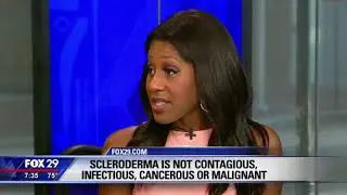 What is Scleroderma? What Are the Symptoms of Scleroderma? A Doctor Explains