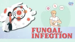 Everything You Need to Know About Itching & Fungal Infection (Daad) | Health Maantra | हेल्थ मंत्रा