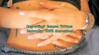 Cheap Tattoo Removal
