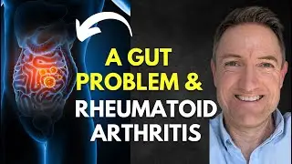 A Gut Problem Rheumatoid Arthritis