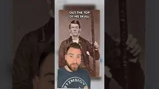 Phineas Gage really said &ldquo;I&rsquo;m built different&rdquo; 😤 and taught us that the frontal cortex plays a