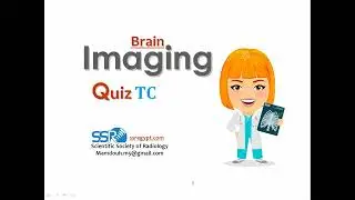 Revision Brain TC Prof.Mamdouh Mahfouz