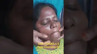 #SKIN FORMULA 9  #Deep Cleansing Oil @luckychannel5333