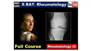 X RAY- Rheumatology (I) #cme #internal_medicine #usmle #medicalstudent #محاضرات_باطنة