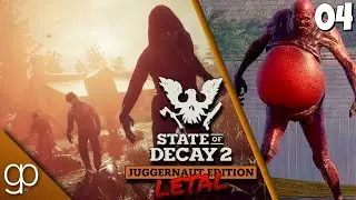 State Of Decay 2 | Ep#04 - Tp3 | Gameplay español - Aqui termina todo | ZONA LETAL |