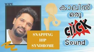 Click sound in hip | Snapping Hip Syndrome | Groin pain