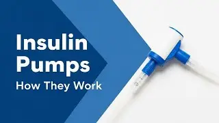 Insulin Pumps: Are They Worth the Cost?