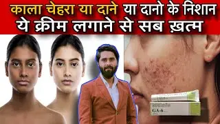 Glycolic acid Cream Benefits & How To Use Correctly Pharmacy cream for Dark Neck, Elbow, #doctorali