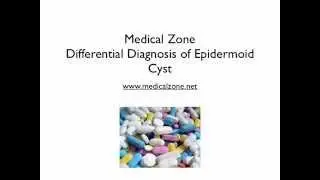 Medical Zone -  Differential Diagnosis of Epidermoid Cyst