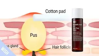 What Happens To Our Skin When We Use AHA Exfoliant? | Best Exfoliator For Flawless Skin