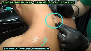 ASMR DEEP SHOULDER ACNE REMOVAL 💈 HAIRCUT 💈 EAR BURN 💈CRACKS💈 tickle head,foot,chest,armpit massage