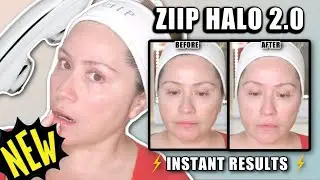 ⚡NEW ZIIP HALO 2.0 | Comparison + DEMO + Before & Afters