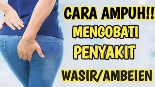 CARA SINGKAT MENGOBATI PENYAKIT WASIR/AMBEIEN TANPA OBAT!! PIJAT REFLEKSI || YLT HERBAL