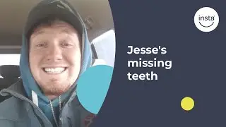 Jesse's Story: Covering Missing Teeth | Instasmile Review