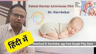 Patent Ductus Arteriosus PDA in hindi 
