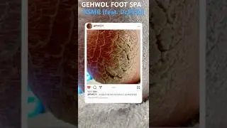 GEHWOL FOOTSPA cracked heels #asmr #cracked #satisfying #pedicure #relax #foot