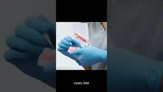Forensic Science Analysis in Bite Marks and Footprints #shorts #forensicscience #teeth #shoes #fact