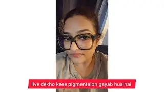 honest review live dekho Miduty ke supplement se kese mera pigment clear hua sach ya jhoot #miduty 