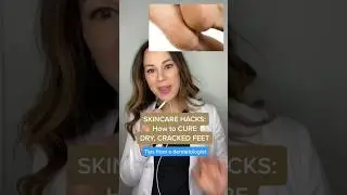How To Cure Dry, CRACKED Feet &mdash; Derm HACKS | #shorts #skincare |