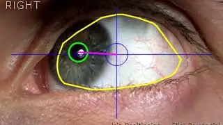 Iris positioning - OpenCv and Python