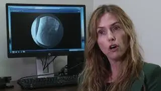 PACEMAKER FOR THE BLADDER