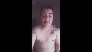 1 mo post op top surgery