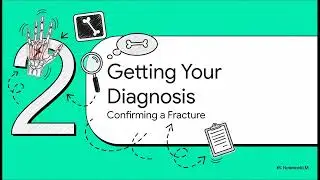 Hand Fracture &ndash; Patient Education Explained | Dr. Colin Hong