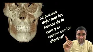 Tienes la Cara y la mandíbula  desviadas? Un ojo mas pequeño que otro? Pueden ser tus dientes!!👁👀