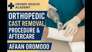 Cast Removal Procedure & Post-Cast Care - Afaan Oromoo