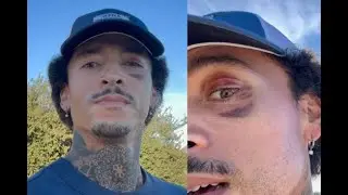 Nyjah Says Brutal Slam Caused a Week of Memory Loss & Non Stop Vomiting, Urges Kids to Wear Helmets