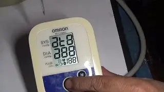 Тонометр Omron M1 Compact - ремонт дисплея