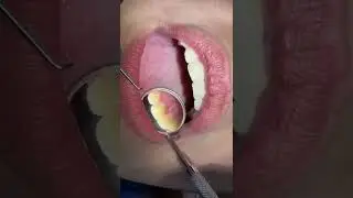 Exploración intra oral y extraoral