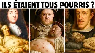 ILS ÉTAIENT TOUS POURRIS ? LE SECRET DES MORTS D’HENRI VIII, CHARLES II ET LOUIS XIV