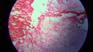endochondral ossification
